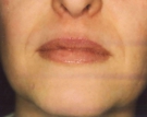 Maturing Face Before
