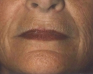 Maturing Face Before