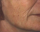 Maturing Face Before