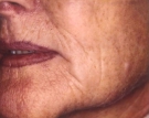 Maturing Face Before