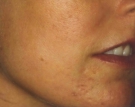 Scars Before