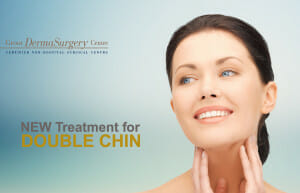 belkyra treatment for double chin best non-surgical