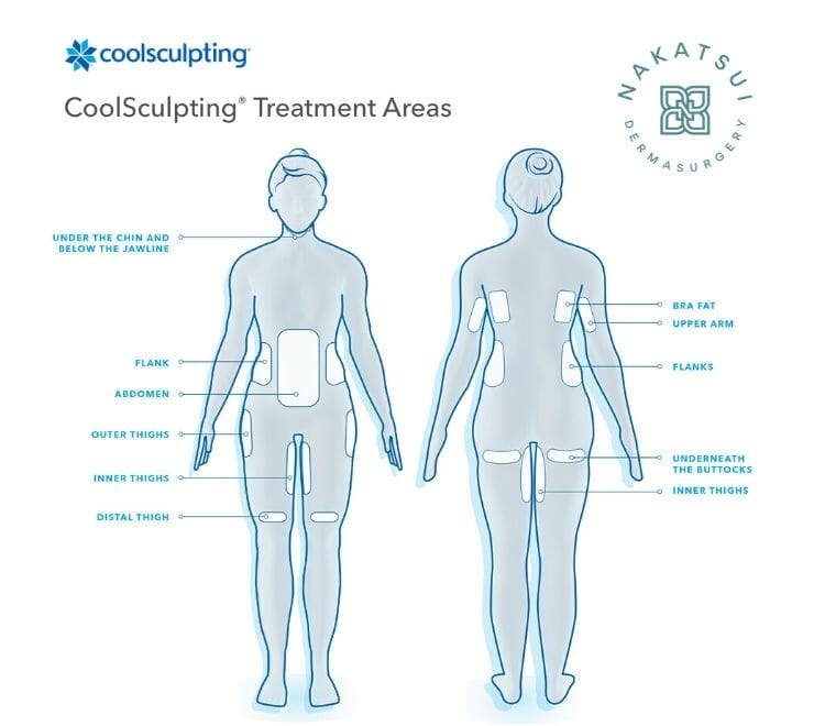 CoolSculptiing Treatment Areas Nakatsui