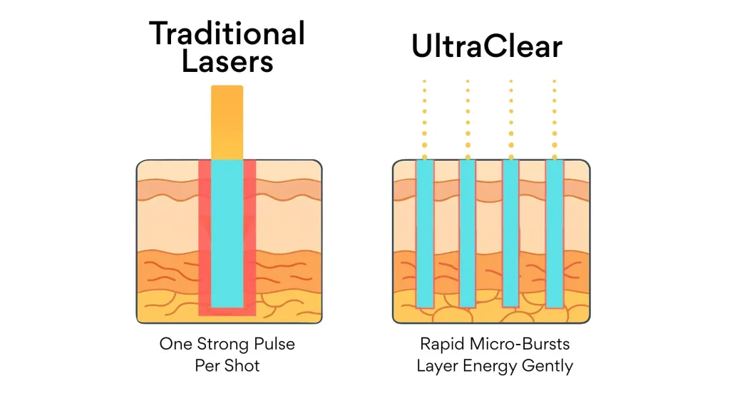 Comparison between older fractional ablative lasers like CO2 and Erbium, and the new UltraClear laser