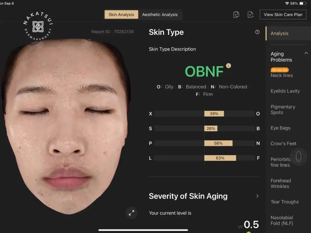 skin analysis report